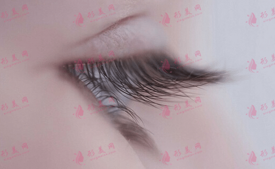 孕睫術(shù)