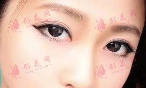 美瞳線