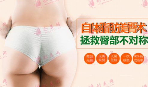 自體脂肪豐臀