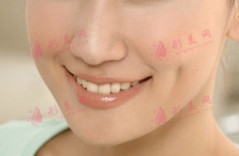 人造酒窩有哪些禁忌？術(shù)后該怎么護(hù)理？