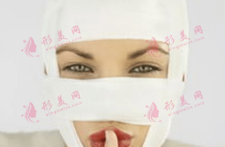 整形技術(shù)