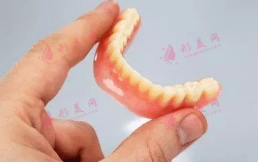 活動(dòng)假牙