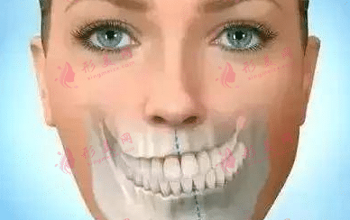 偏頜