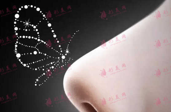 膨體隆鼻