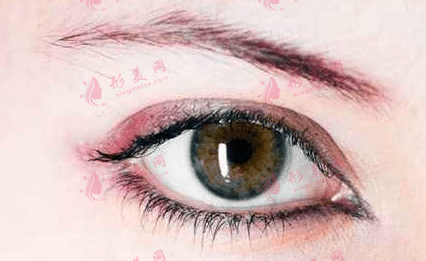 開內(nèi)眼角