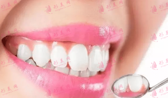 牙齒矯正
