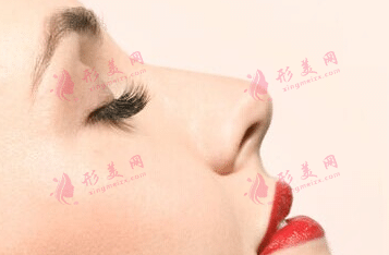 假體隆鼻 假體隆鼻