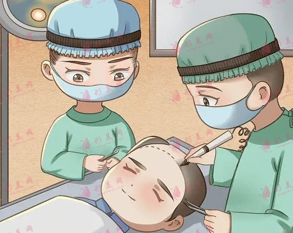 頭發(fā)移植是如何工作的？