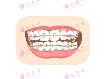 北京私立口腔醫(yī)院排名前十榜盤(pán)點(diǎn)！中諾、圣貝、拜博等醫(yī)院實(shí)力上榜