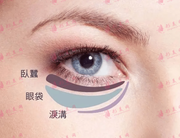 溶脂去眼袋手術(shù)多少錢?激光溶脂去眼袋果好嗎?