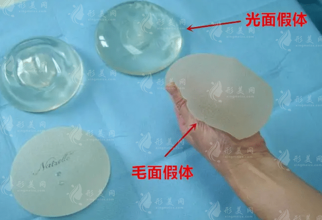 內(nèi)窺鏡豐胸手術(shù)恢復(fù)期長不長?
