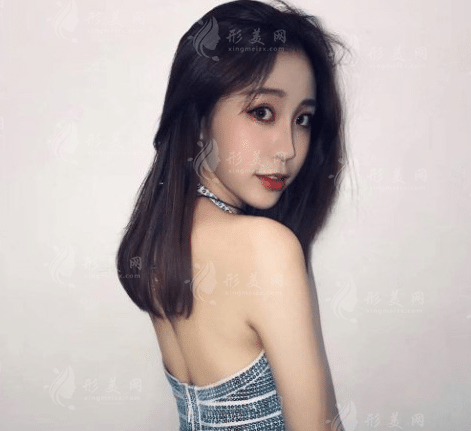 武漢五洲整形美容醫(yī)院面部提升價(jià)格貴嗎？收費(fèi)表及案例公布