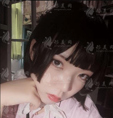 上海九院韋敏磨骨怎么樣？顴骨下頜角價格表|手術(shù)案例鑒賞