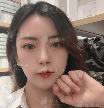 武漢協(xié)和醫(yī)院整形科做雙眼皮怎么樣？醫(yī)院實力及案例一覽