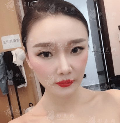四川華西醫(yī)院光子嫩膚效果怎么樣？醫(yī)院實(shí)力及案例分享