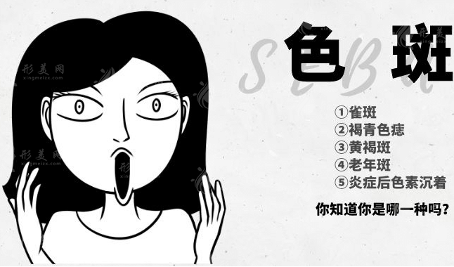 上海治療雀斑多少錢一次?