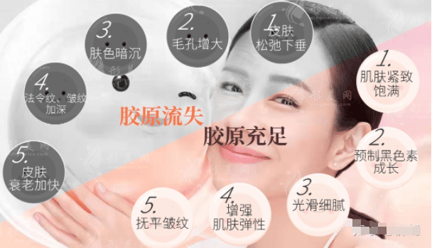 膠原蛋白怎么補(bǔ)？外涂、注射、口服？哪種方式最有用？