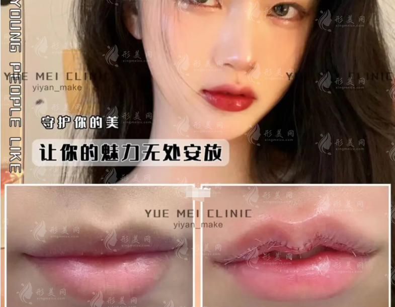 國內(nèi)唇部整形知名專家，管果，王曉健，張園園怎么樣？
