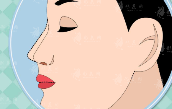 上海九院鼻修復(fù)要多少錢(qián)？實(shí)力醫(yī)生介紹+案例分享+價(jià)目表