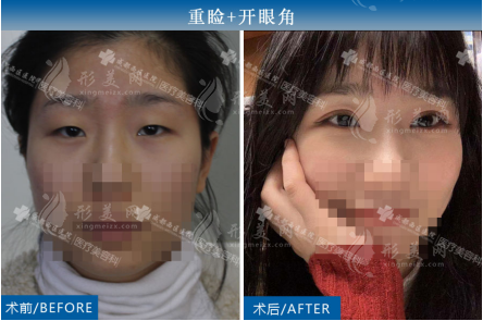 楊世界案例展示