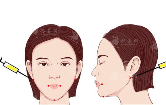 上海薇琳整形吸脂怎么樣？實(shí)力醫(yī)生介紹、吸脂案例分享、附價(jià)格表