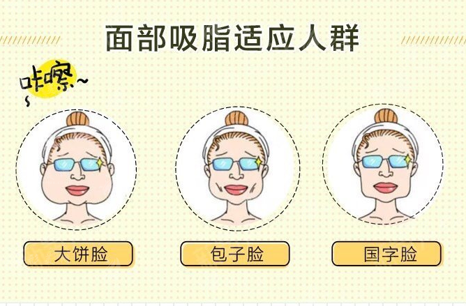 面部吸脂效果怎么樣？面部吸脂適用于所有人嗎？