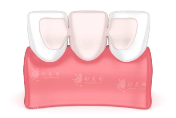 美容冠矯正牙齒的步驟如何？初步評(píng)估和診斷、維護(hù)和保養(yǎng)…