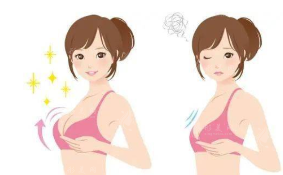 豐胸下垂應(yīng)該怎么修復(fù)？