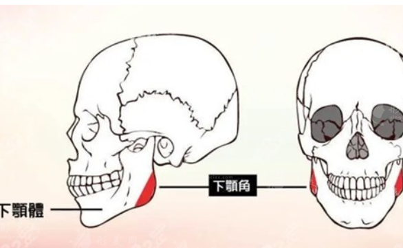 下頜角整形手術(shù)危險(xiǎn)嗎？來詳細(xì)討論下