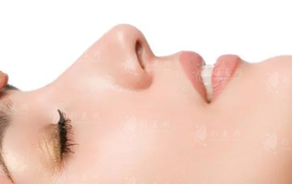 皮膚縫合法延長(zhǎng)鼻小柱有哪些步驟呢？