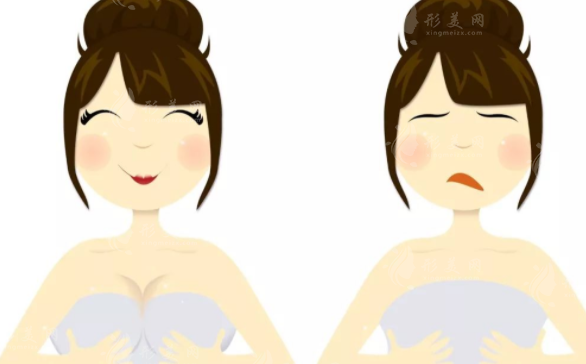 雙平面隆胸技術(shù)有哪些優(yōu)勢？