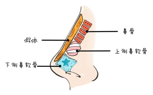 酒糟鼻切割術與劃痕術的區(qū)別有哪些？