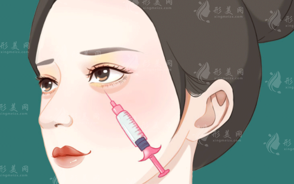 玻尿酸打臥蠶有風(fēng)險(xiǎn)嗎？主要包括哪些方面？