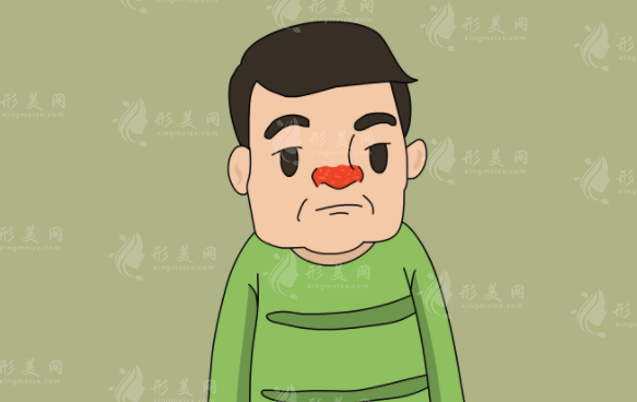酒糟鼻可以根治嗎？下面將從以下幾個(gè)方面進(jìn)行探討