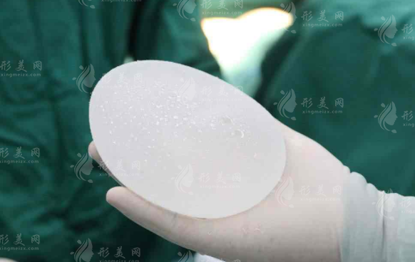 假體隆胸多久取出來比較好？考慮因素有哪些呢？