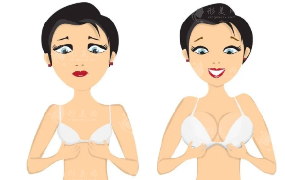 假體隆胸多久取出來(lái)比較好？考慮因素有哪些呢？