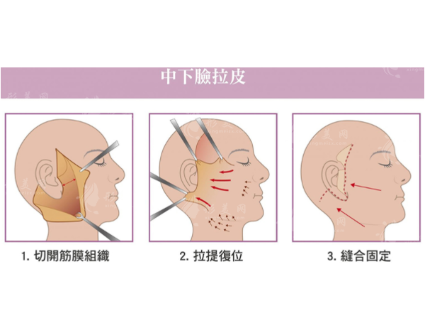 北京京城皮膚醫(yī)院王馳拉皮手術(shù)多少錢？技術(shù)優(yōu)勢(shì)，醫(yī)院地址信息。