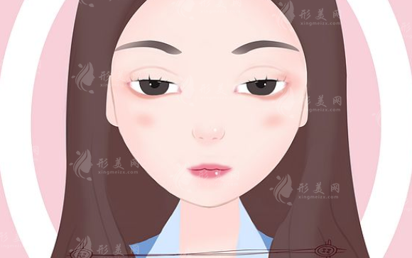 上瞼下垂幾歲做手術(shù)好？手術(shù)適宜年齡、原理科普一覽！