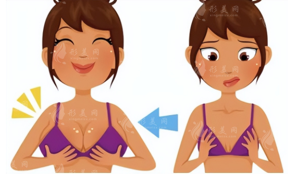 隆胸會(huì)影響母乳喂養(yǎng)嗎？科普一覽