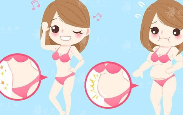 不是所有人的肥胖都適合吸脂，吸脂手術(shù)會不會反彈？
