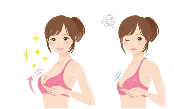 隆胸失敗了醫(yī)院會(huì)免費(fèi)修復(fù)嗎？失敗后如何進(jìn)行針對(duì)性修復(fù)？