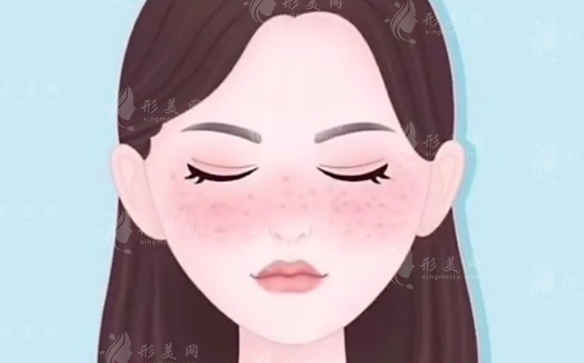 超皮秒祛斑會(huì)反彈嗎？有什么副作用？