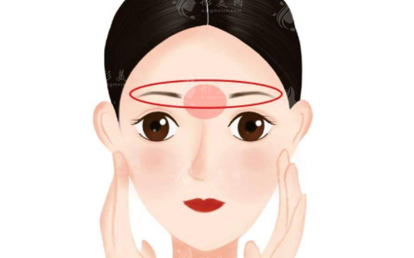 墊眉骨手術(shù)來改善眉弓凹陷、雙眼無神！眉骨愈高愈好嗎？