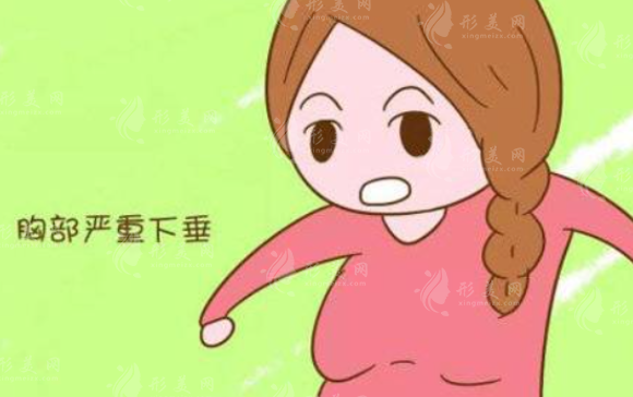 乳房下垂矯正手術(shù)費(fèi)用貴嗎？術(shù)后會(huì)反彈嗎？