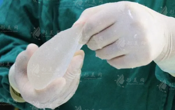 假體隆胸手術(shù)能做局麻嗎？局麻好還是全麻好？