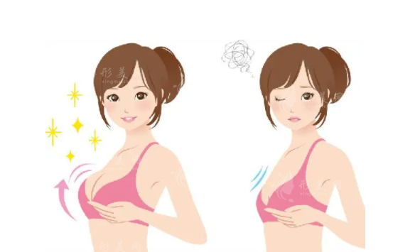 內窺鏡雙平面隆胸效果怎么樣？收費貴嗎？