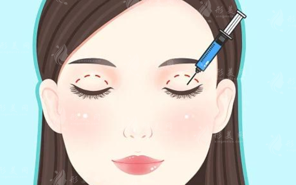蘇州美萊雙眼皮整形多少錢？醫(yī)生信息、整形價格表分享