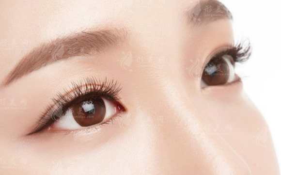 微創(chuàng)雙眼皮能維持多久？術(shù)后注意事項(xiàng)有哪些？