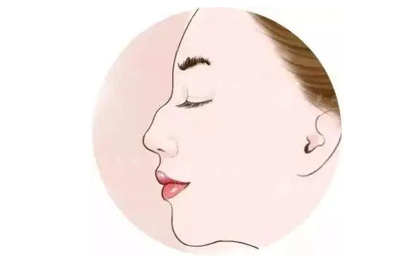 濟(jì)南海峽美容整形隆鼻怎么樣？專家團(tuán)隊(duì)+項(xiàng)目介紹+收費(fèi)價(jià)格