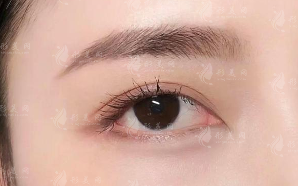 眉毛種植一般需要多少錢？術(shù)后注意事項(xiàng)有哪些？